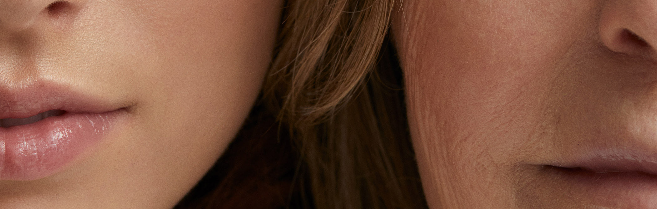 Fine Lines & Wrinkles