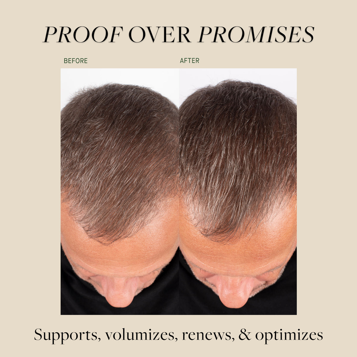 Hair Renewal Supplement