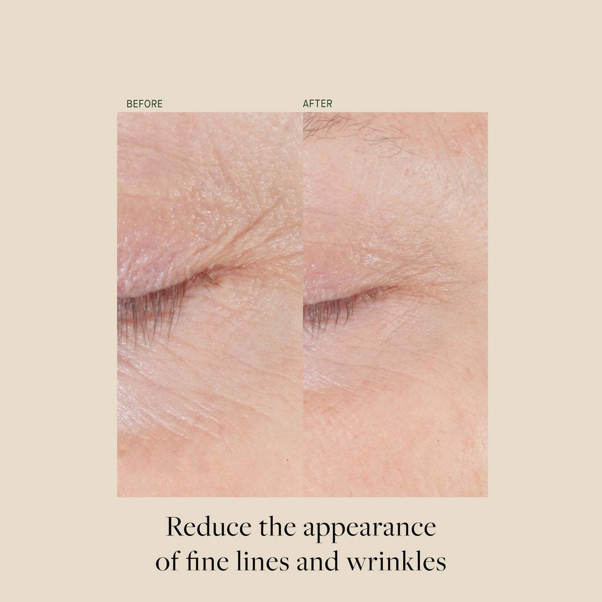 Form Control™ Marine Collagen Gel
