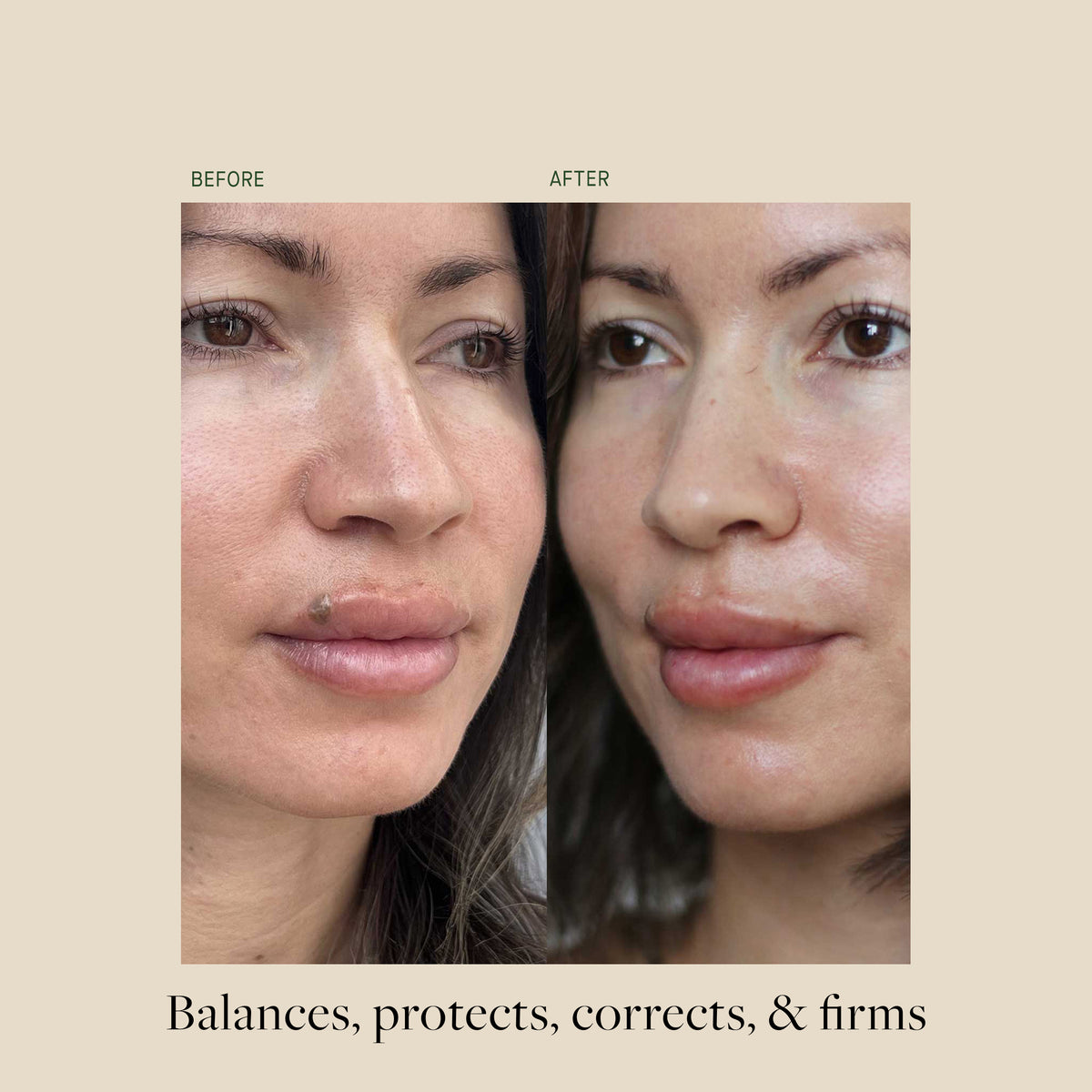 PH+ Enzyme Essence