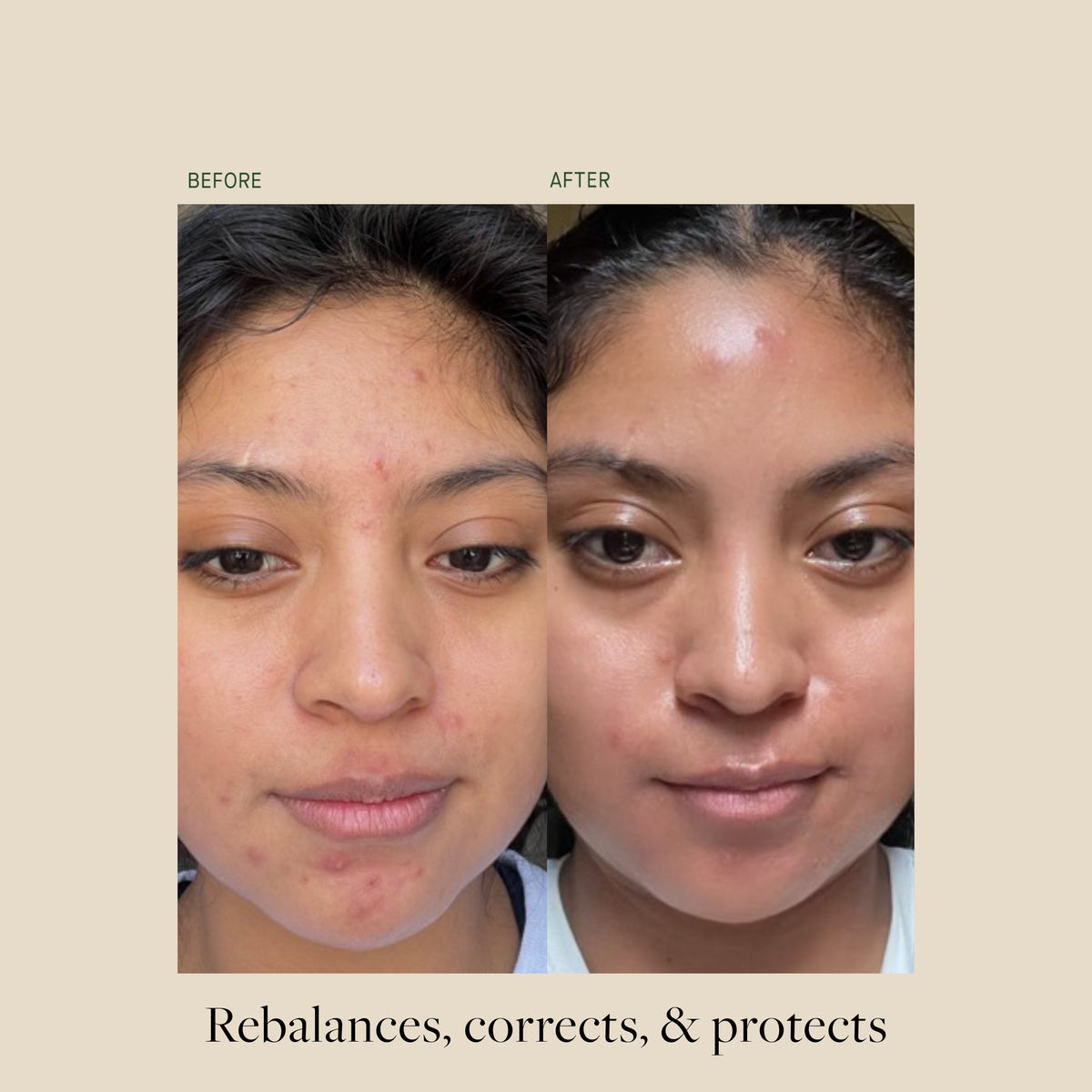 VitaBiome™ Active Skin Optimizer