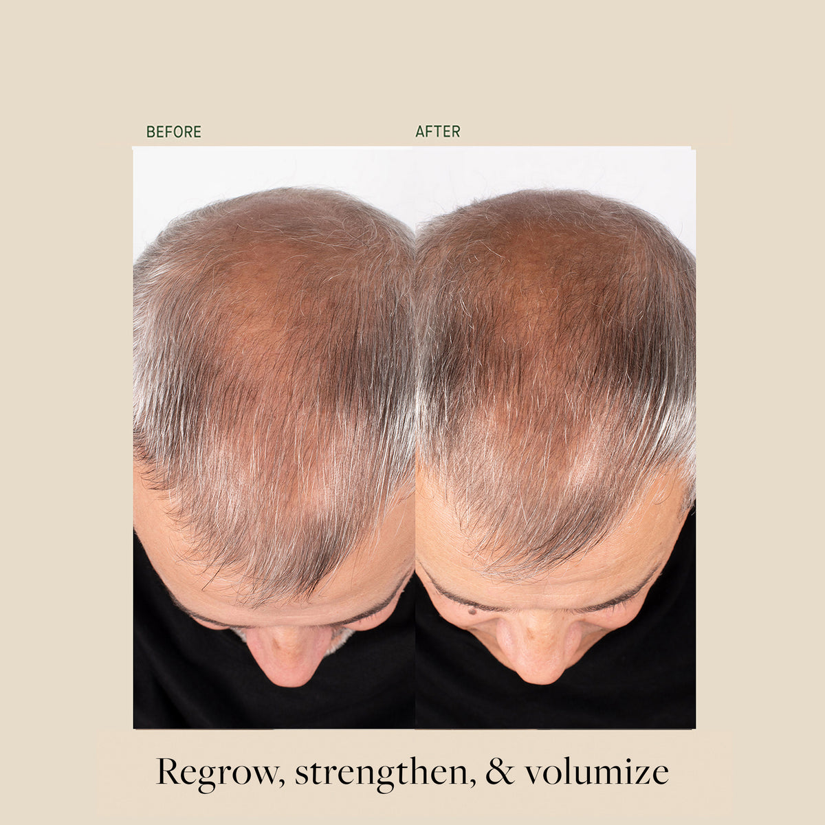 Bio-Ferment Scalp & Hair Treatment