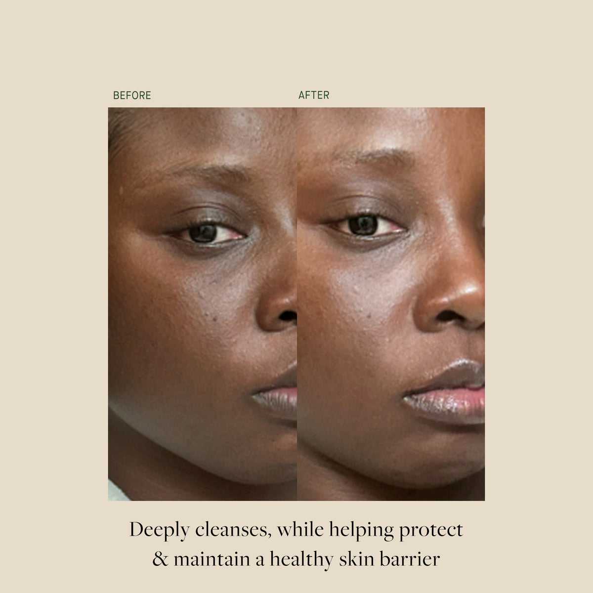 KB5™ Calming Gel Cleanser