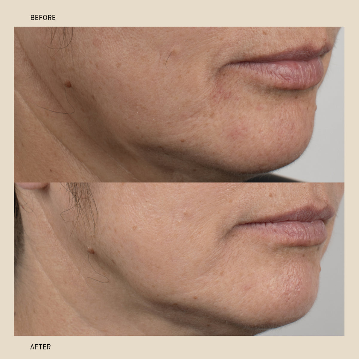 Amino Protein Mask