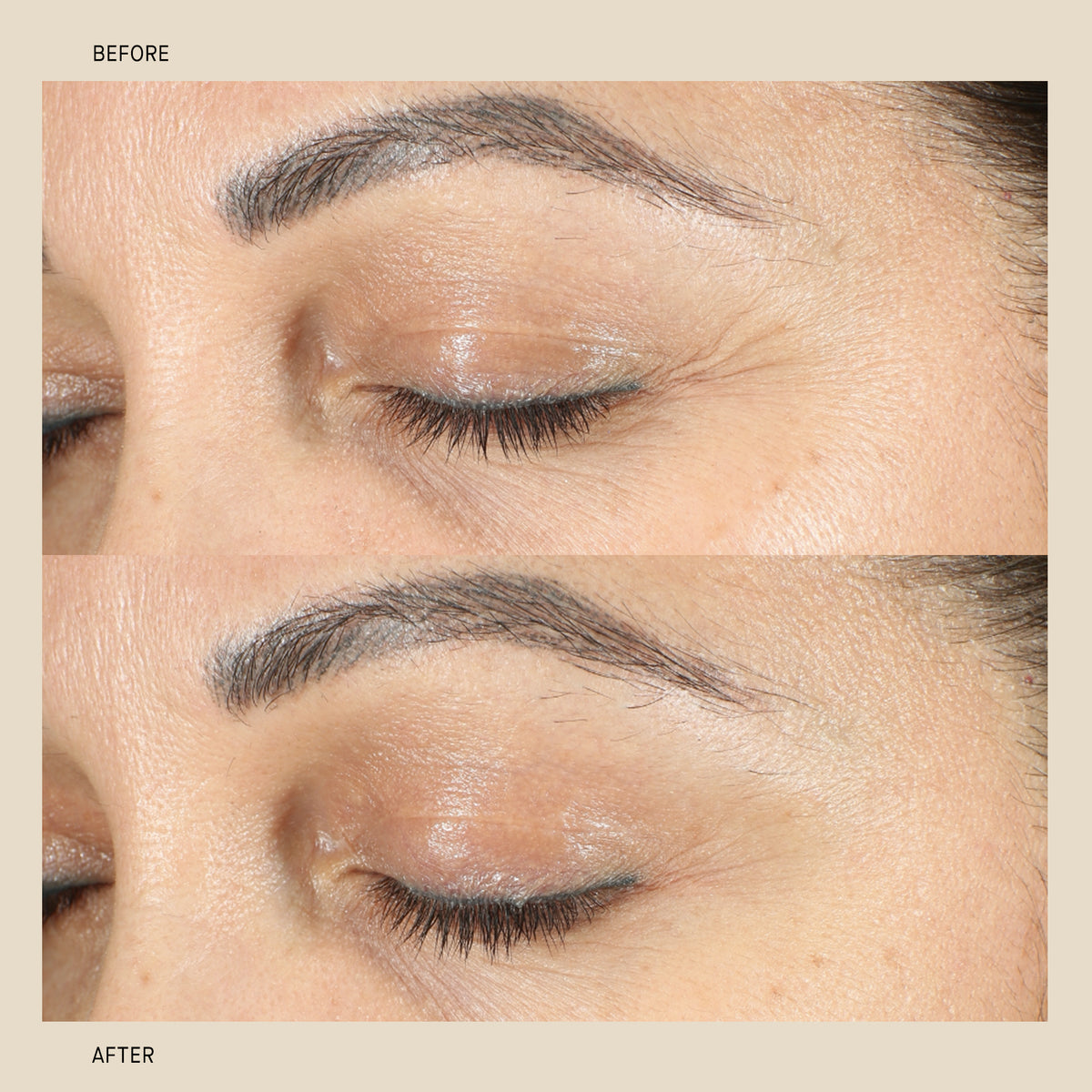 BioCell Correcting Serum