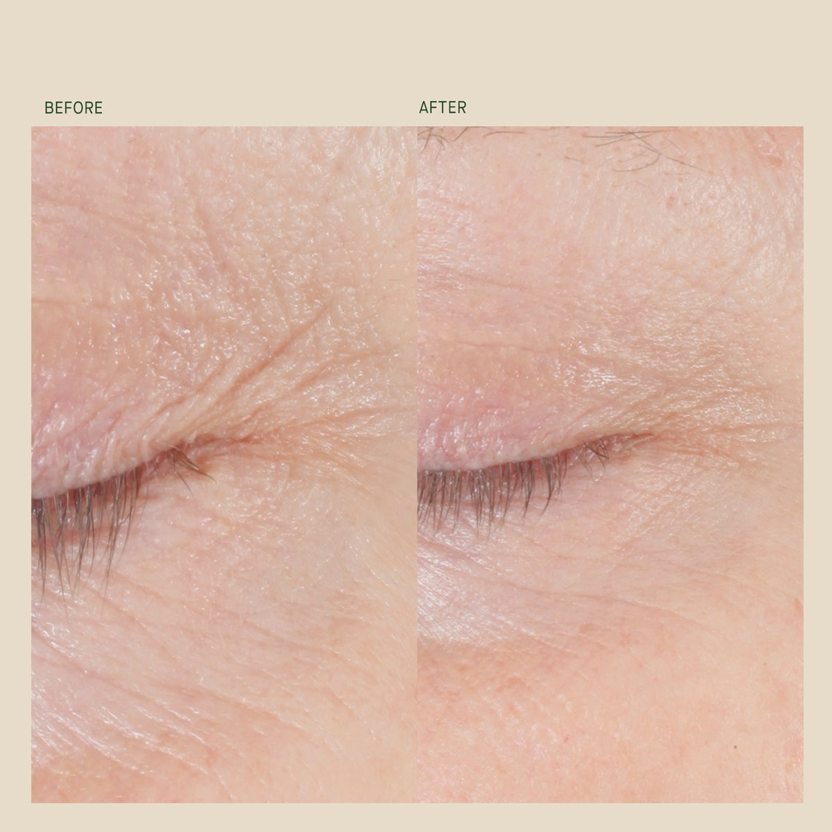 Form Control™ Marine Collagen Gel