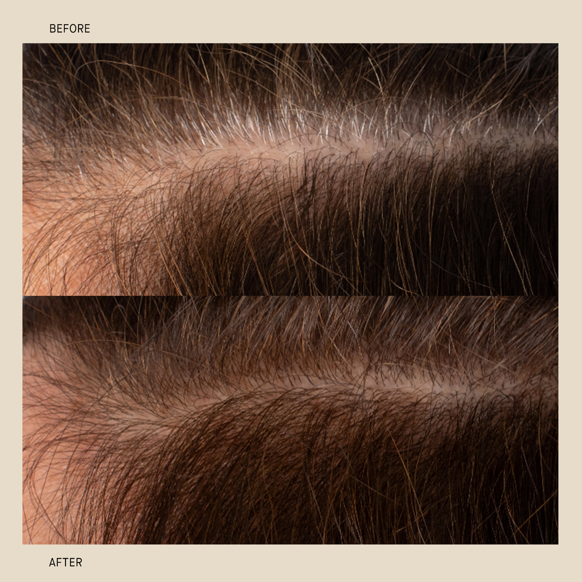 Bio-Ferment Scalp & Hair Treatment