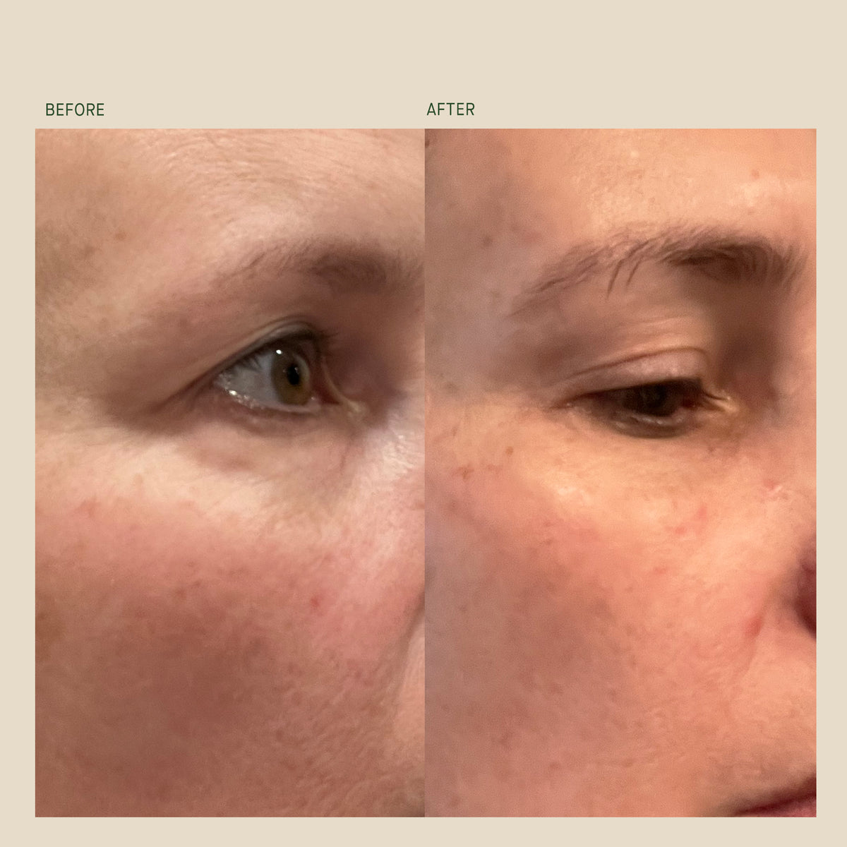 Bio-Correcting Face Cream