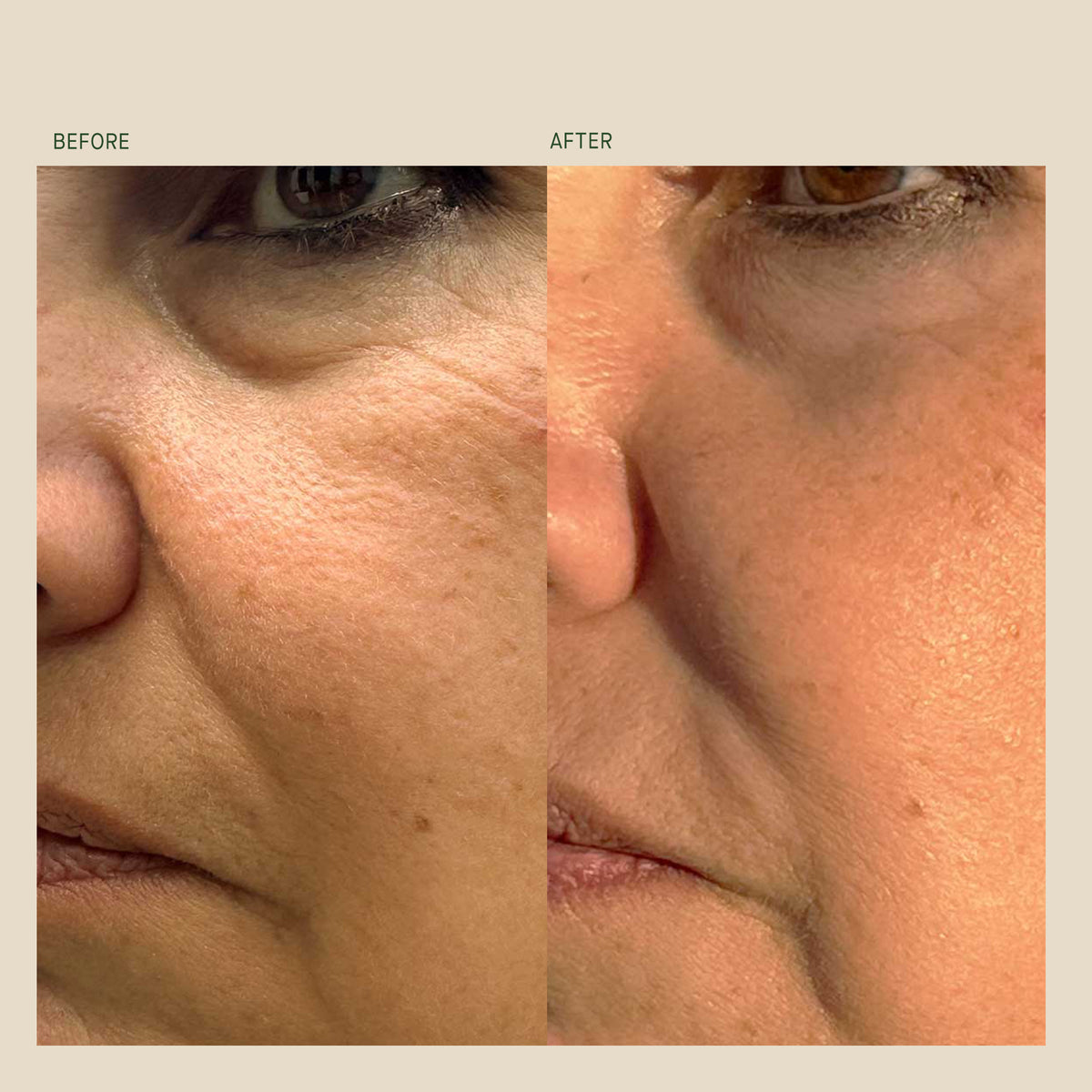 Bio-Correcting Face Cream