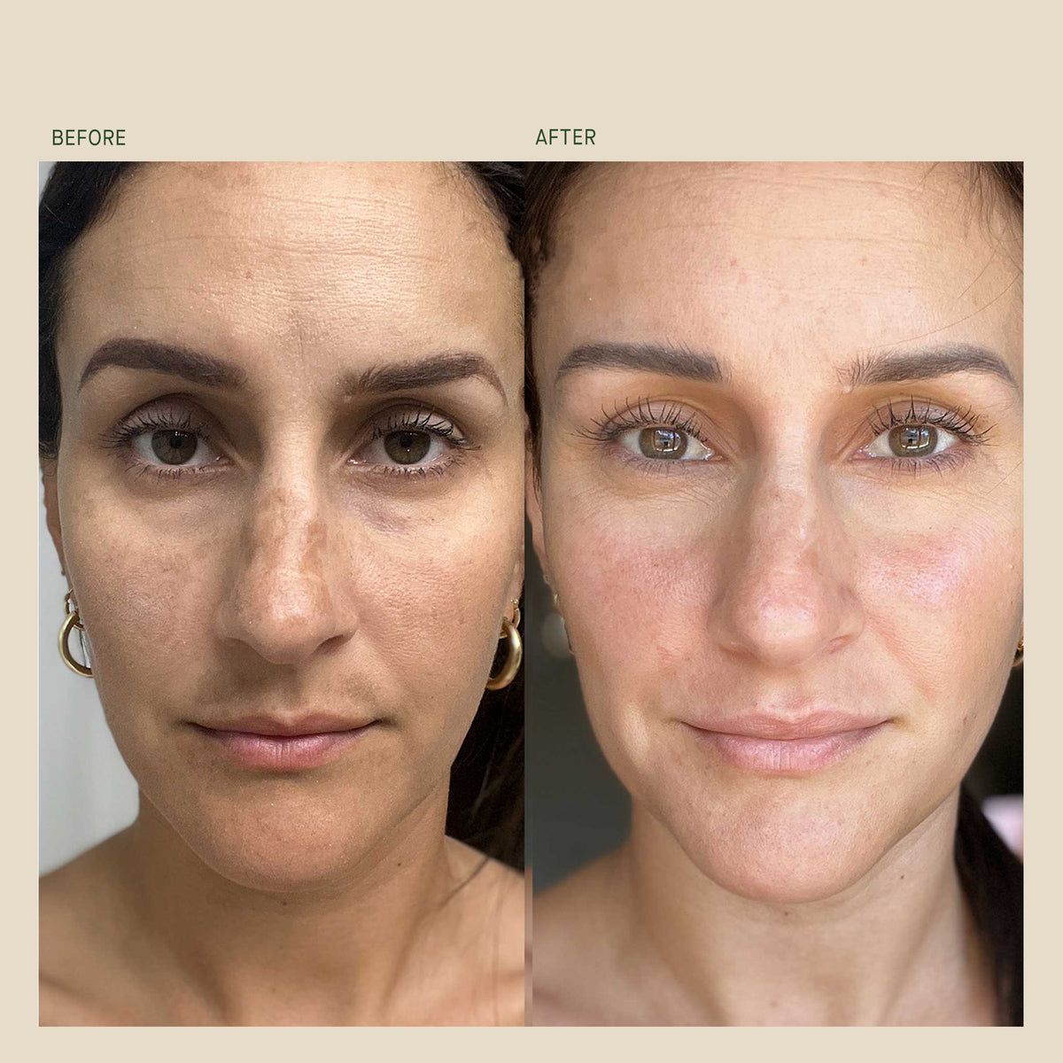 BioCell Correcting Serum