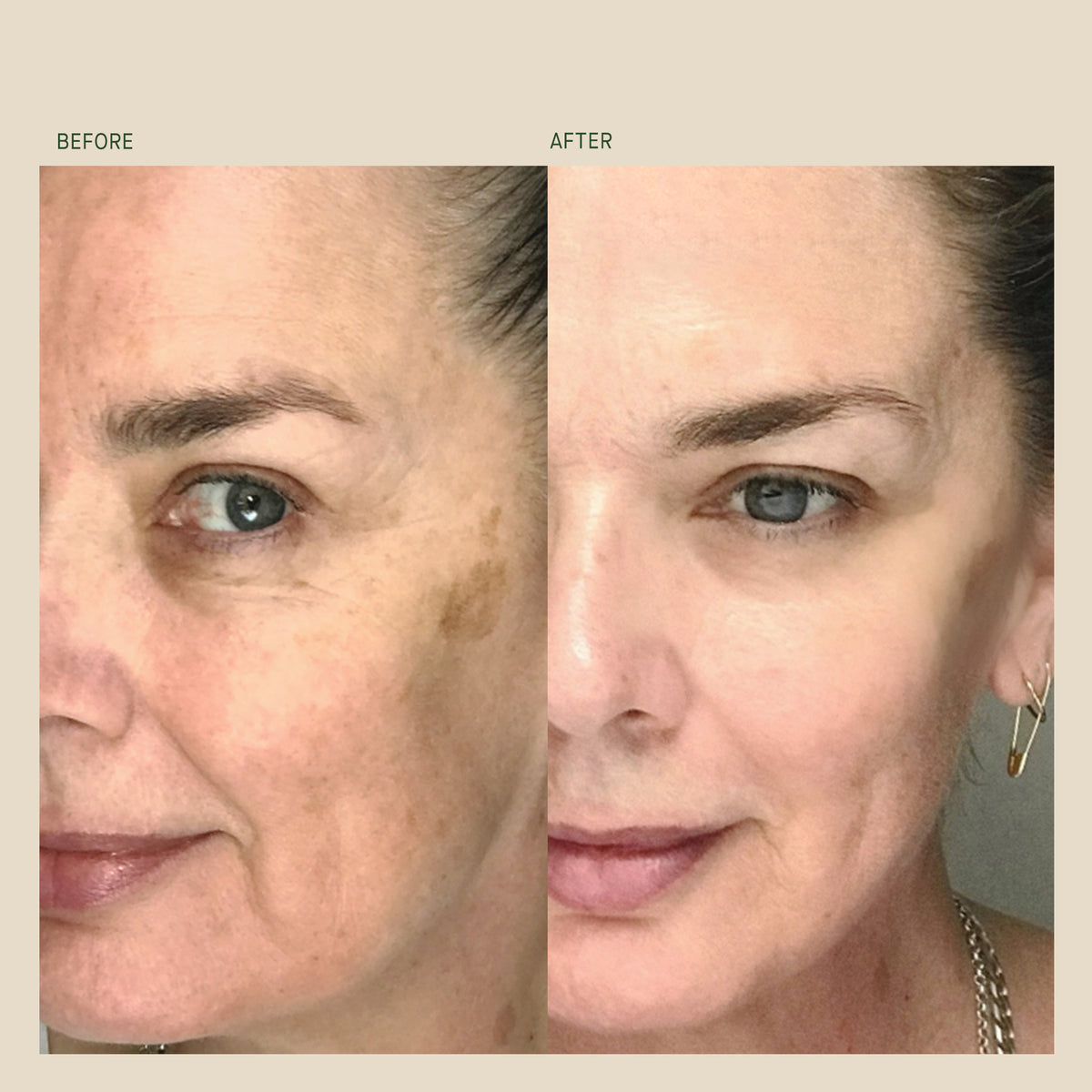 BioCell Correcting Serum