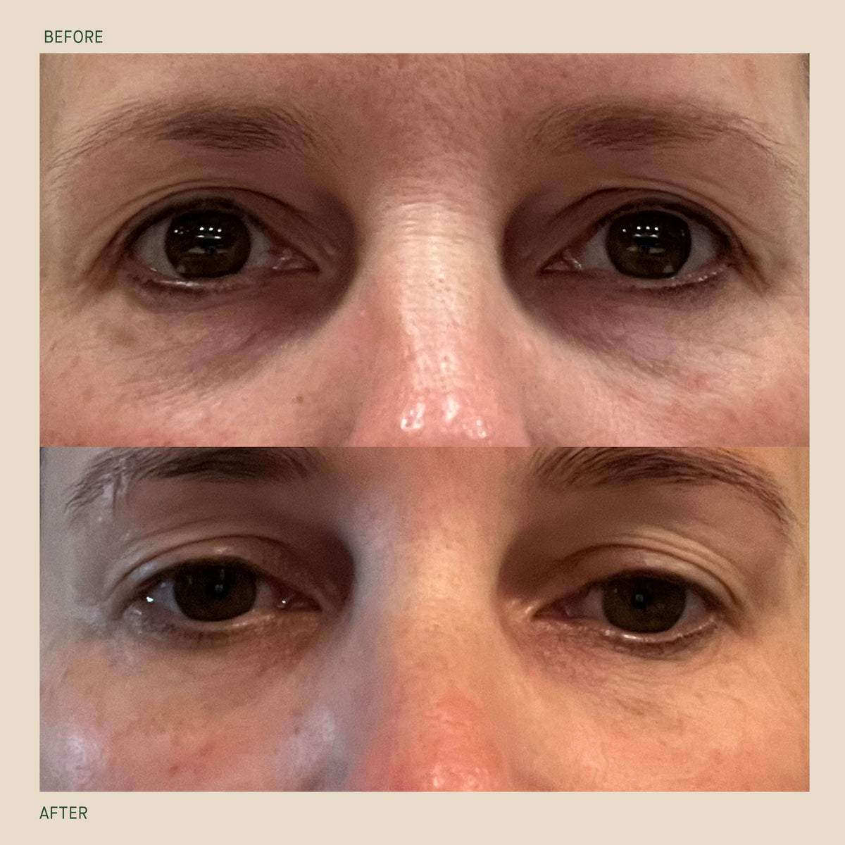 Rosehip Intense Recovery Eye Serum
