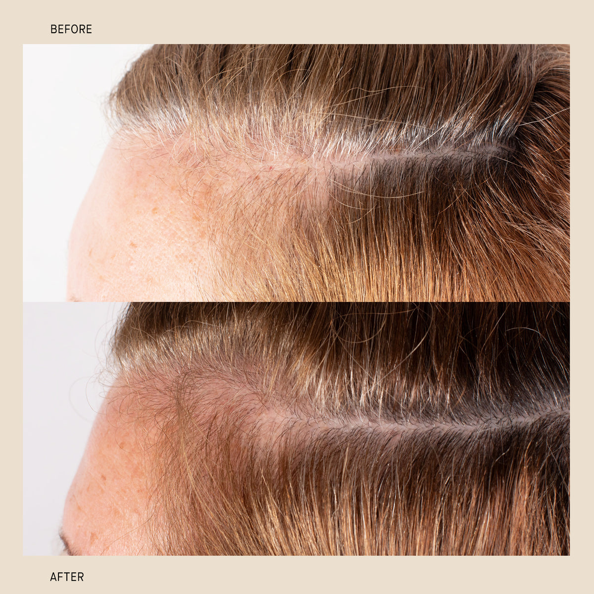 Bio-Ferment Scalp & Hair Treatment