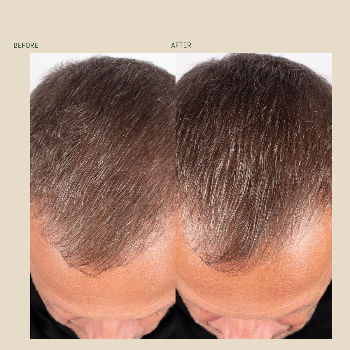 Hair Renewal Supplement