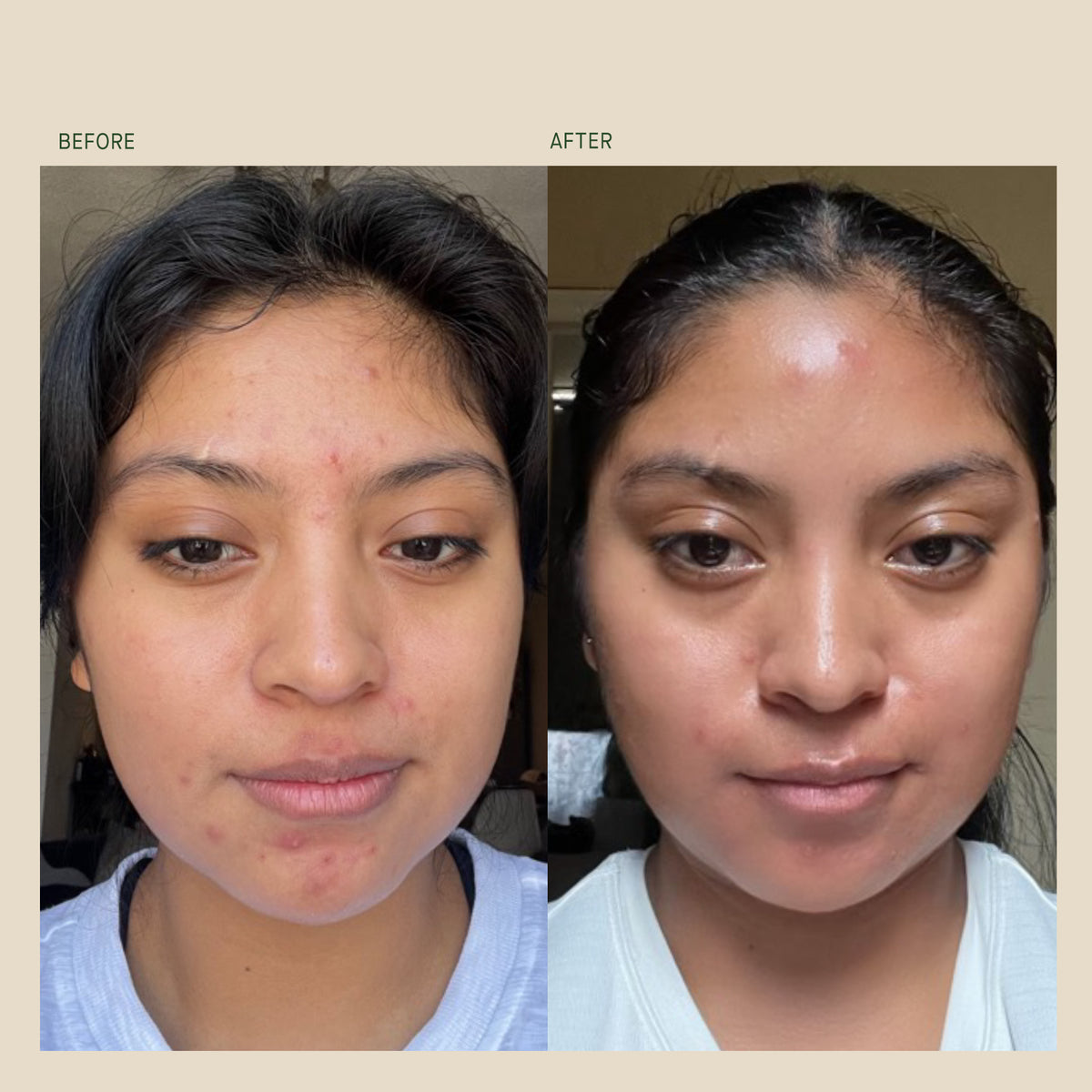 VitaBiome™ Active Skin Optimizer