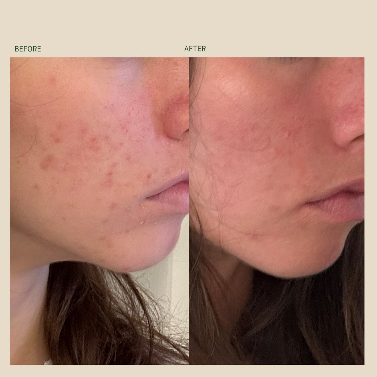 VitaBiome™ Active Skin Optimizer