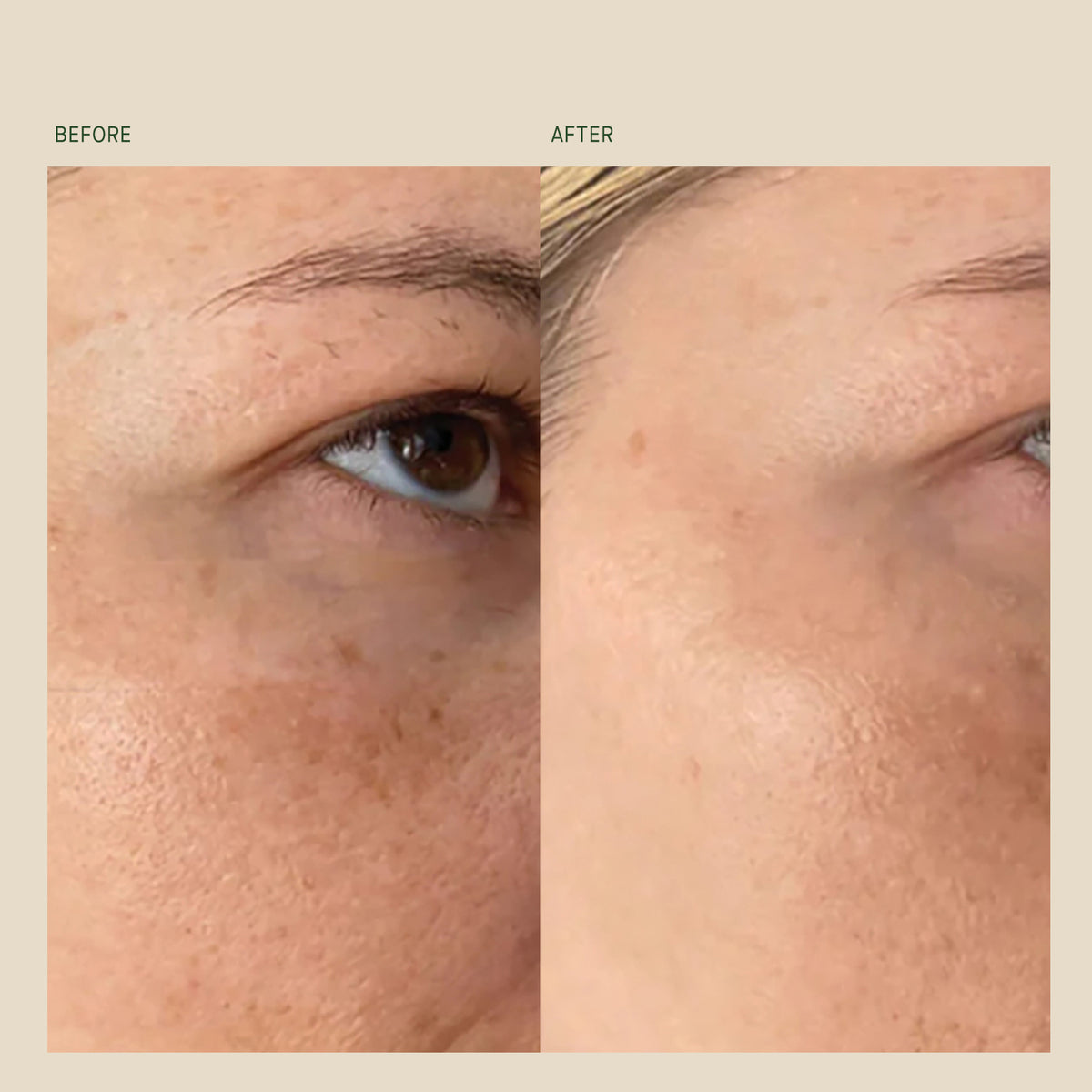 Vitamin C Intensive Face Cream