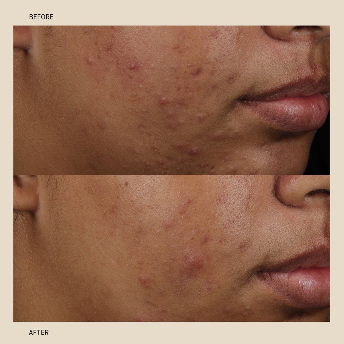VitaBiome™ Active Skin Optimizer