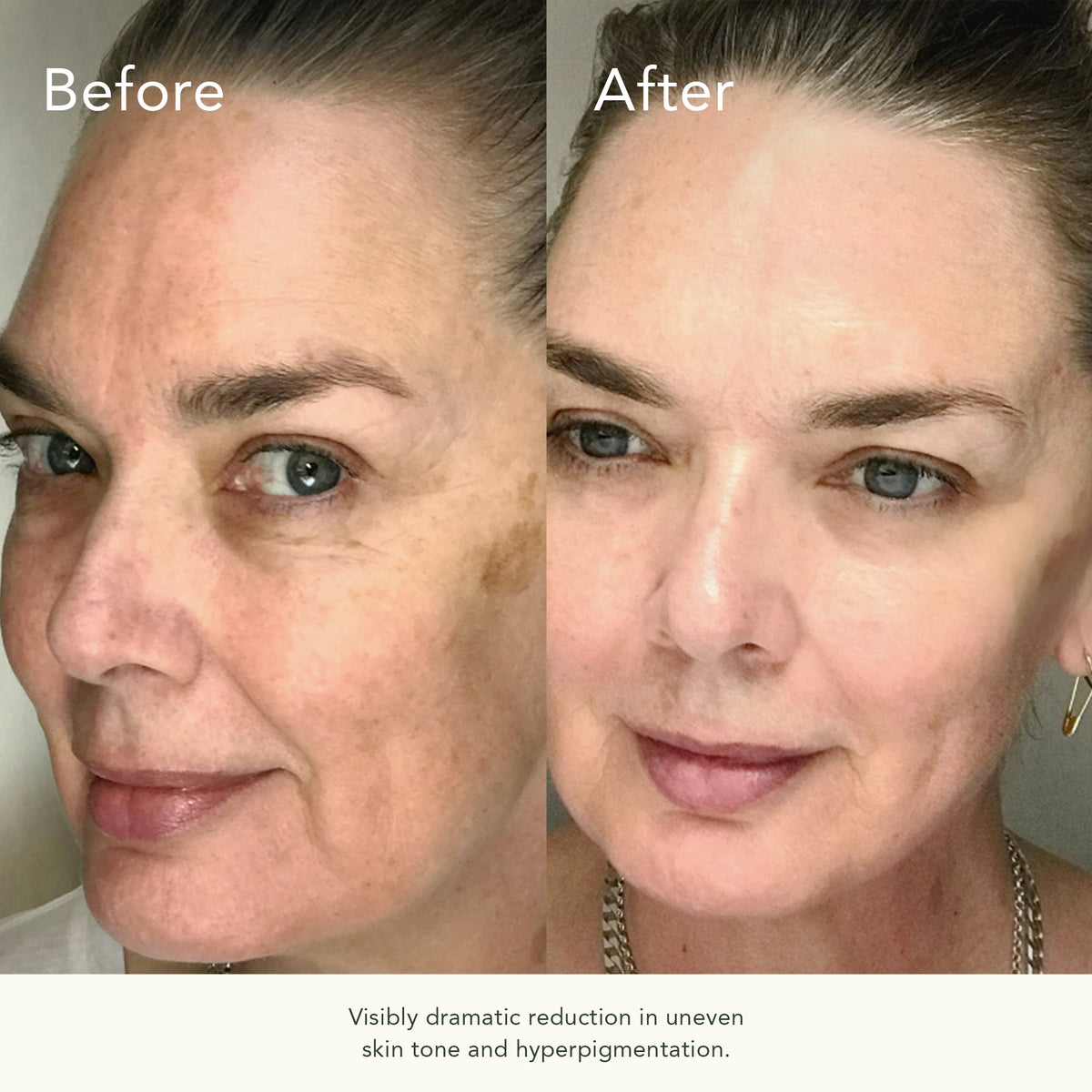 Bio-Correcting Face Cream