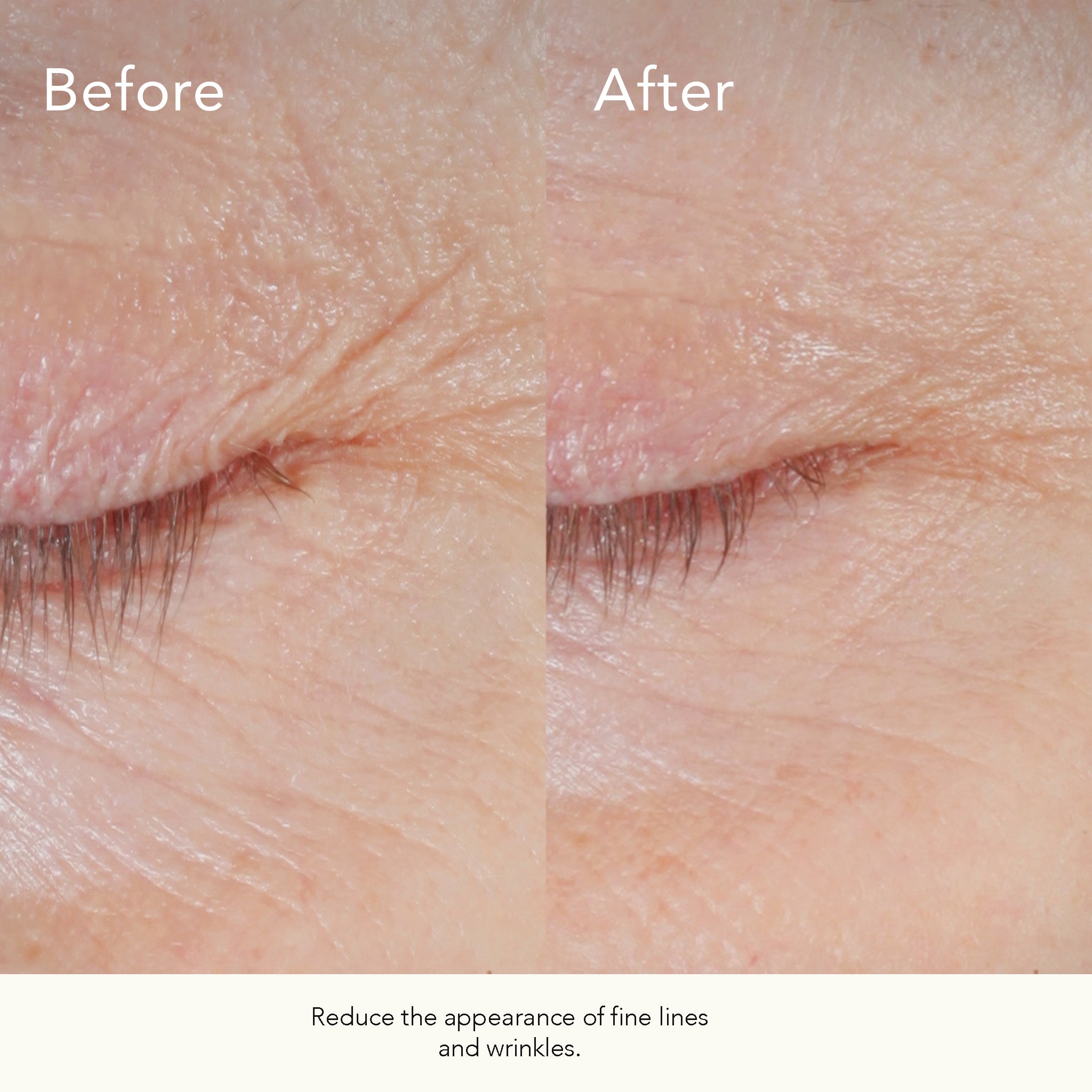 blog-1-1 Form Control™ Marine Collagen Gel - Kat Burki Skincare