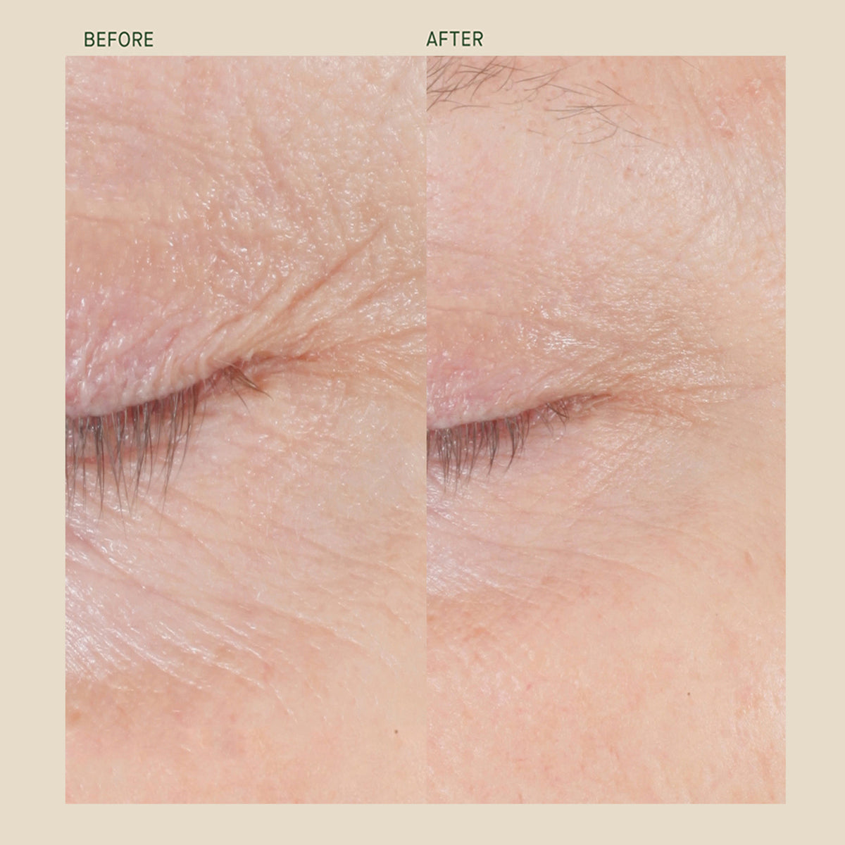 Form Control™ Marine Collagen Gel