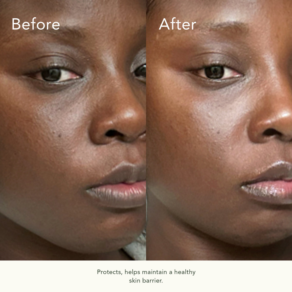 KB5™ Calming Gel Cleanser