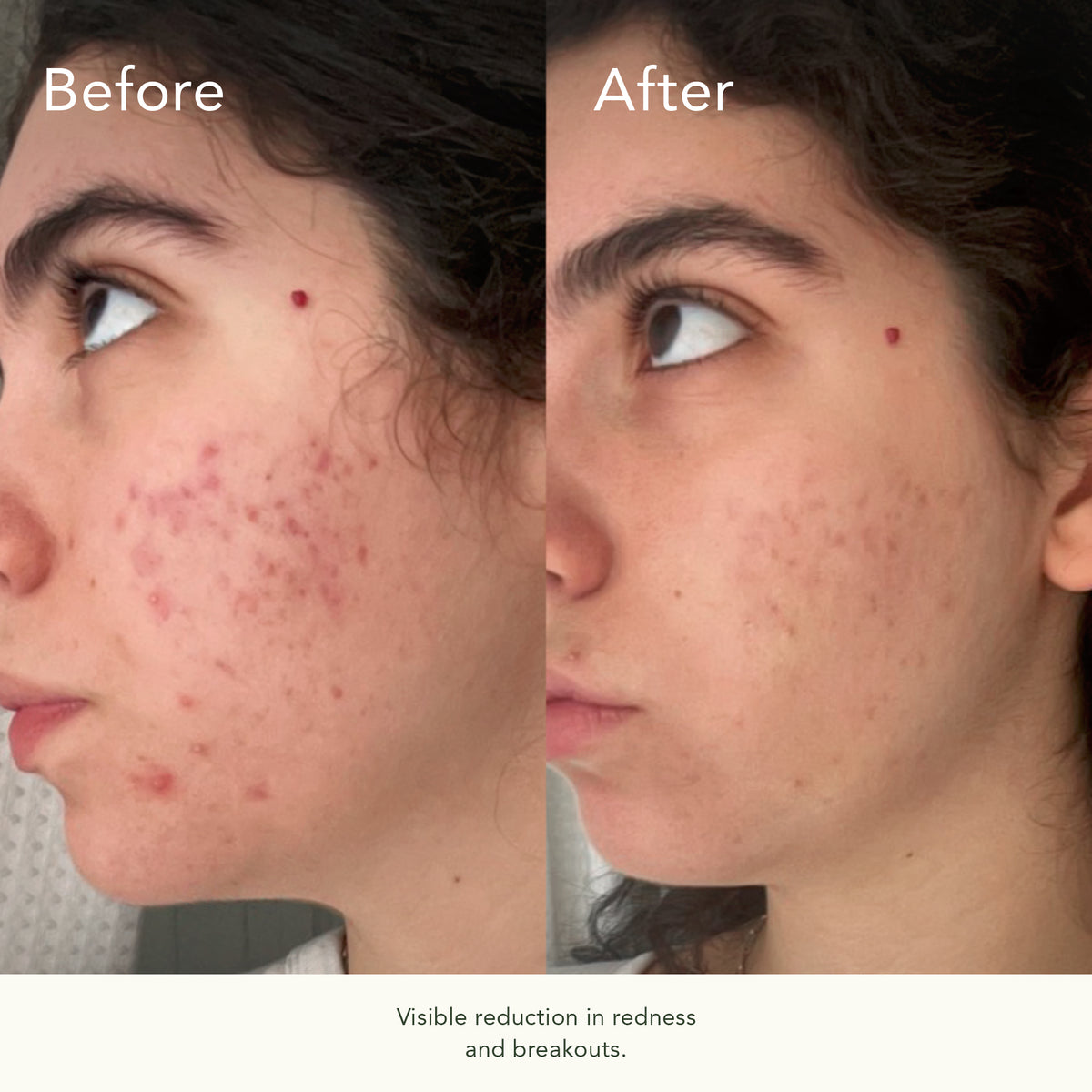 VitaBiome™ Active Skin Optimizer